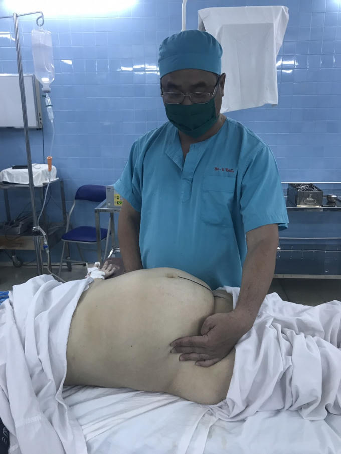 BS Nguyễn Văn Tiến đang khám cho một bệnh nhân, ông được ví là  “phao cứu sinh” của những bệnh nhân hiểm nghèo có hoàn cảnh khó khăn.