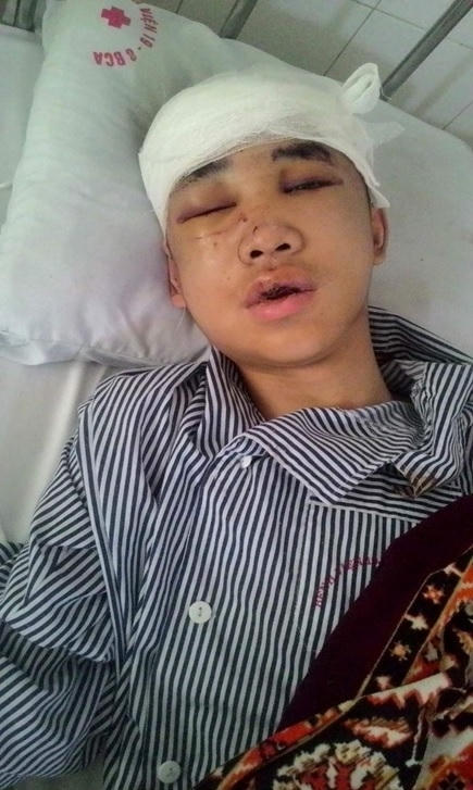 Nạn nhân Lê Quang Hưng cấp cứu tại Bệnh viện 19.8 trong tình trạng hôn mê sâu.