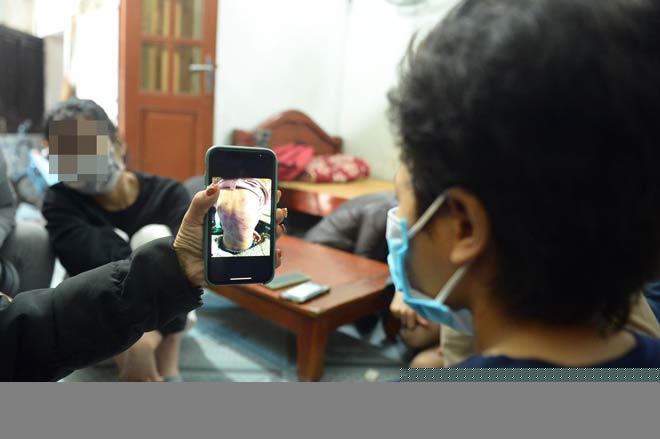 Khi nhìn lại hình ảnh em bị đánh bầm tím B. không khỏi rùng mình