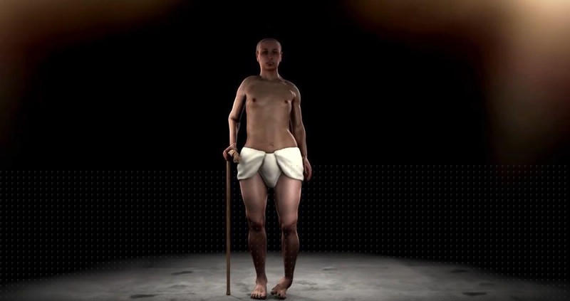 Phác họa về Vua Tutankhamun với dị tật thứ phát không rõ nguyên nhân ở bên chân trái.