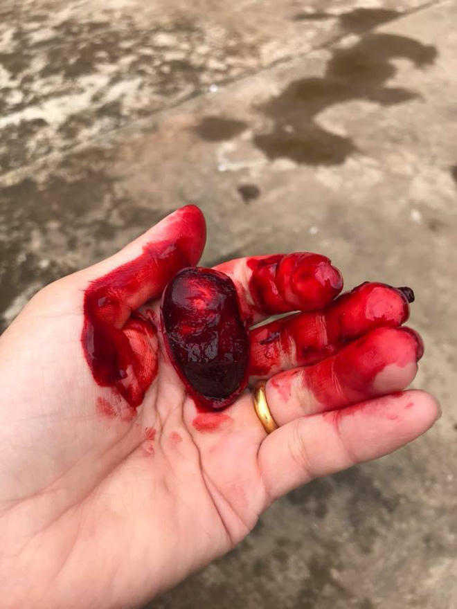 Và nhìn bức hình thứ 2 đã biết nguyên nhân nhưng vẫn chưa hết sợ.