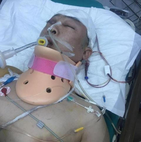 Nạn nhân Nguyễn Văn Lợi đang hôn mê sâu, điều trị tại BV Việt Đức