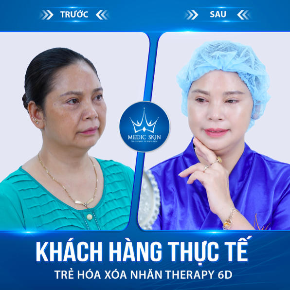 Khách hàng hài lòng với kết quả bất ngờ tại VTM Quốc Tế Medic Skin.