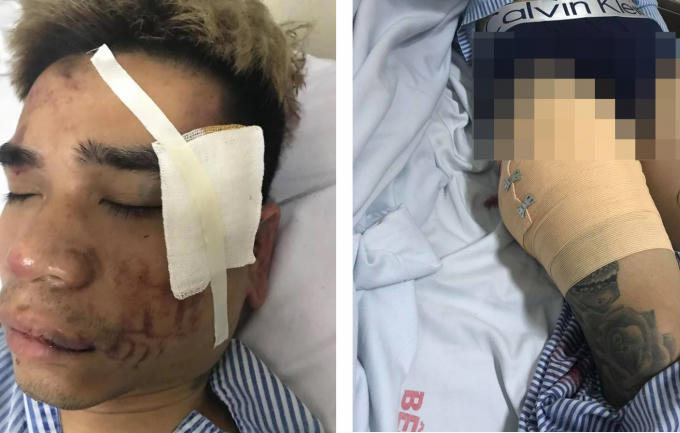 Chủ quán cắt tóc tại bệnh viện.