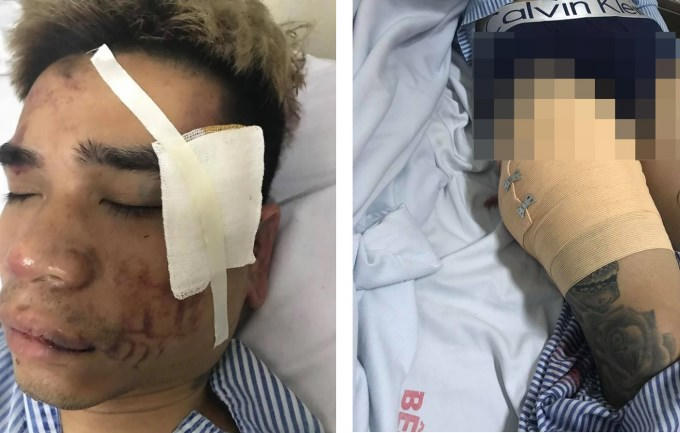 Chủ quán cắt tóc tại bệnh viện.