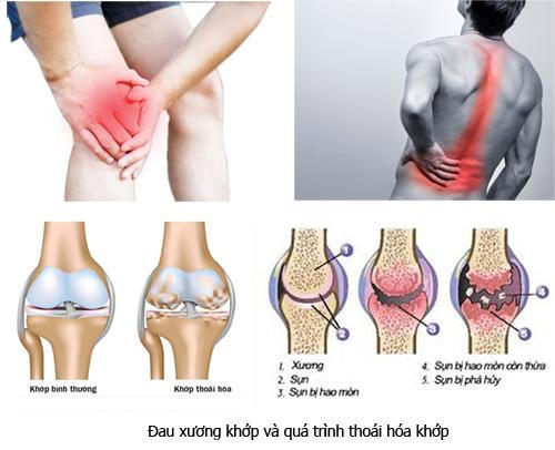Bệnh viện Bạch Mai kh&aacute;m, tư vấn miễn ph&iacute; bệnh cơ xương khớp