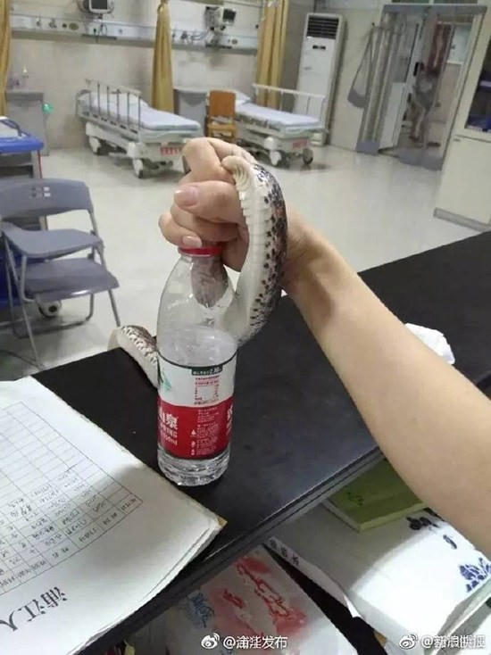 Mỏi quá thì nhét đỡ vào chai.