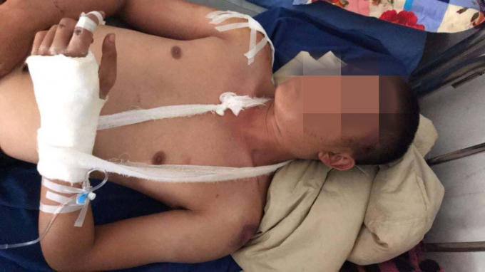 Nạn nhân đang được điều trị tại bệnh viện.