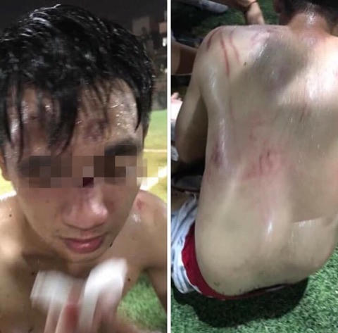 Hình ảnh một người bị thương nặng.