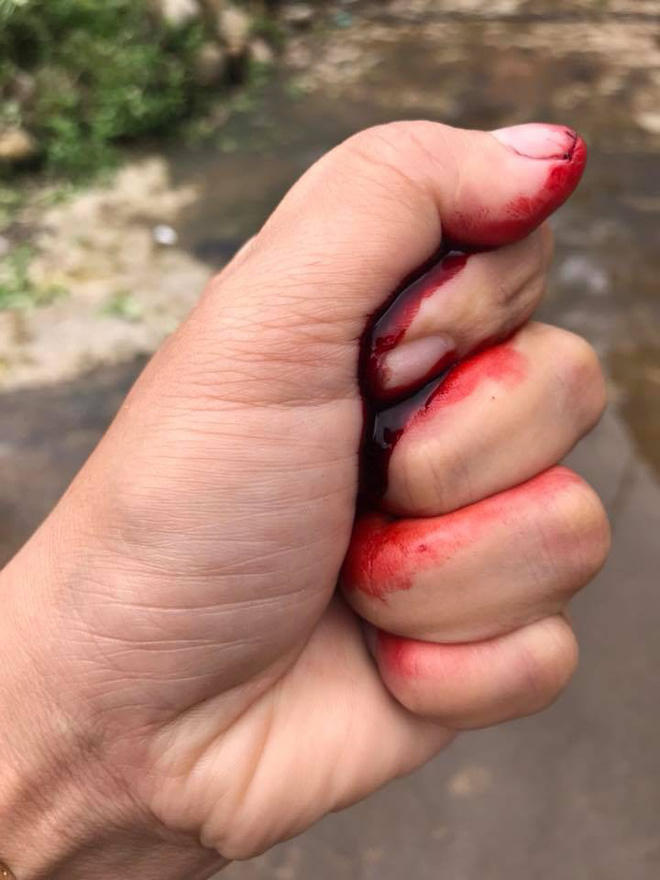Nhìn bức ảnh này ai cũng ngỡ bàn tay đang đầm đìa máu.