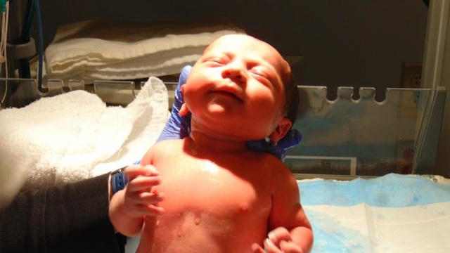 Sau khi lấy và đông lạnh mô buồng trứng từ 11 năm trước, người phụ nữ đã được cấy ghép lại và sinh hạ một bé trai khỏe mạnh.