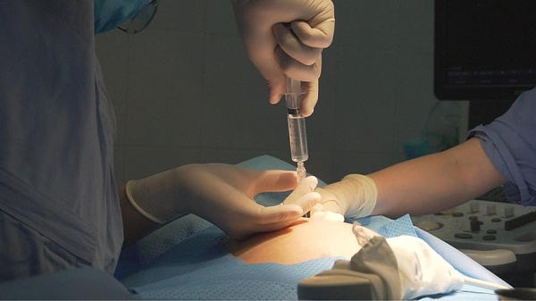 PGS.TS Vũ Văn Tâm thực hiện kỹ thuật điều trị thiểu ối cho thai phụ.