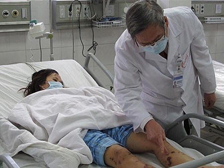 Nhằm chủ động phòng chống bệnh do não mô cầu gây nên, Bộ Y tế đã công văn đề nghị các Sở Y tế tăng cường các biện pháp phòng chống bệnh. Ảnh minh họa.