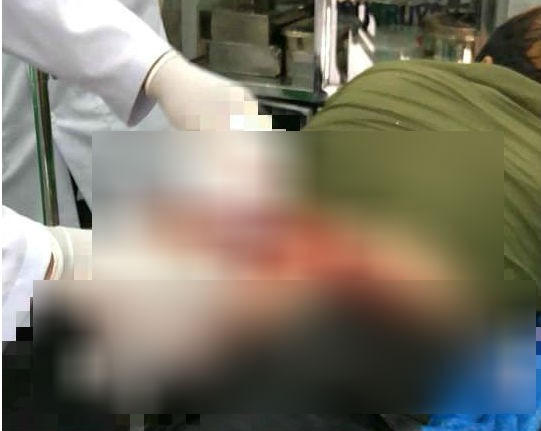 Nam thanh niên bị cắt đứt mông được đưa tới cấp cứu