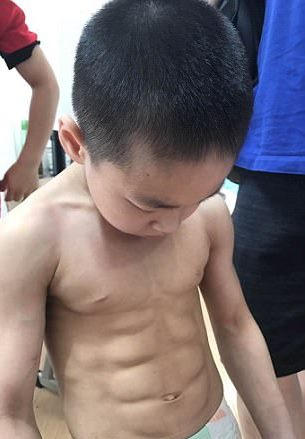 Cậu bé có tới 8 cơ bụng thay vì 6 múi.