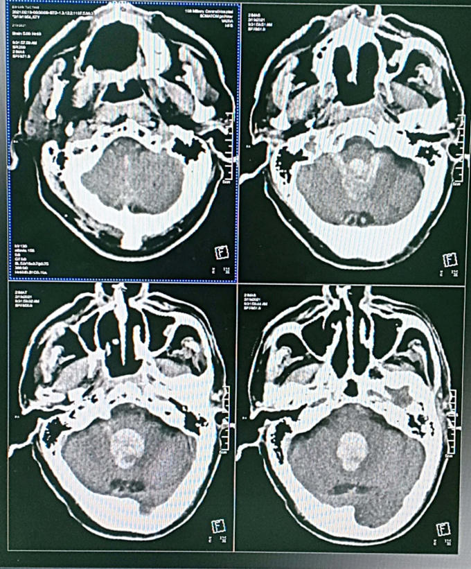 nguoi-dan-ong-ha-noi-chay-mau-nao-dong-thanh-khuon-1