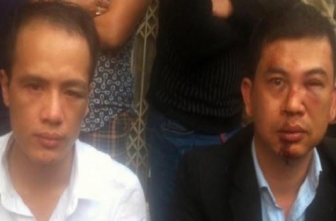 Hai luật sư bị hành hung sau khi đến làm việc với gia đình bị hại Đỗ Đăng Dư.