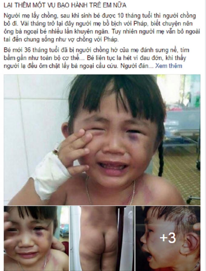 Câu chuyện về bạo hành trẻ em làm dân mạng phẫn nộ. (Nguồn: Facebook).