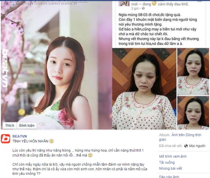 Tâm sự của người phụ nữ bị chồng đánh đến biến dạng khuôn mặt. Nguồn: Facebook.