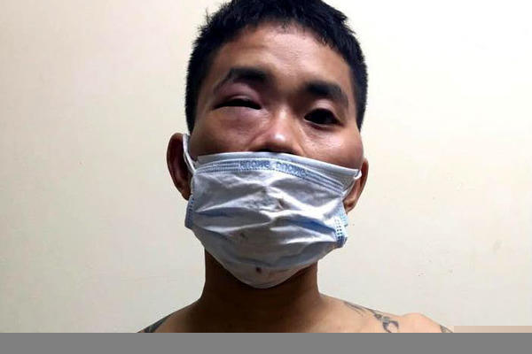 Nam thanh niên bị tạm giữ
