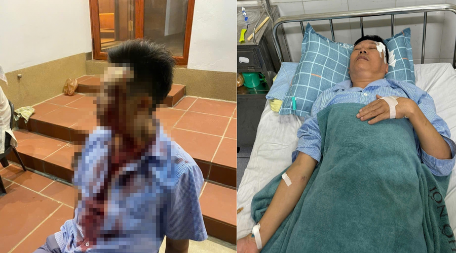 Ông Hán bị gây thương tích phải nhập viện.