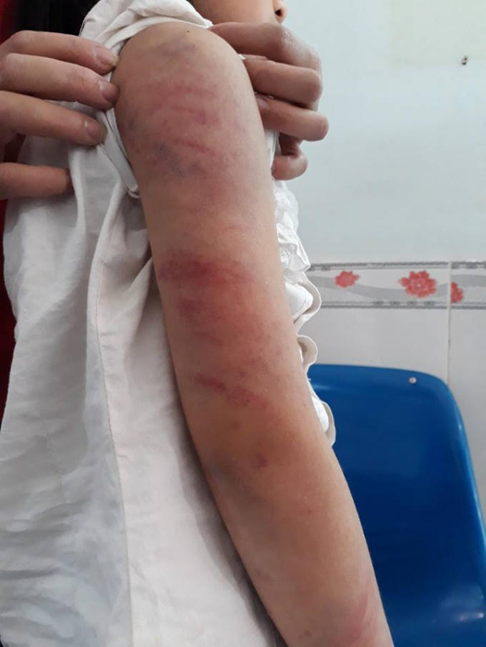 ông La nghiện rượu, thường xuyên say sỉn (ảnh Facebook)