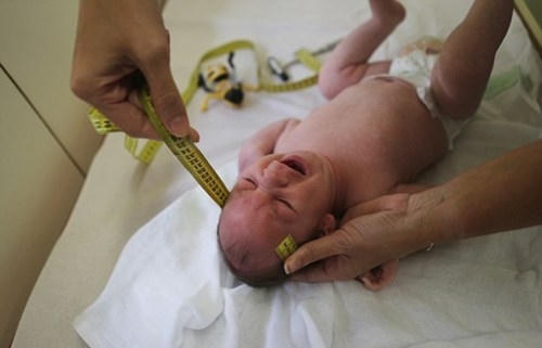 Zika có thể làm cho thai nhi mắc bệnh đầu nhỏ. Ảnh minh họa