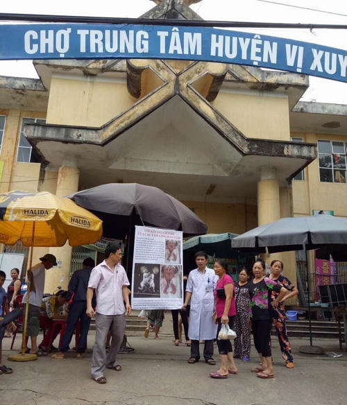 PGĐ BV cùng các cán bộ y tế ra chợ trung tâm để ủng hỗ 2 bé. (Ảnh: BVCC).