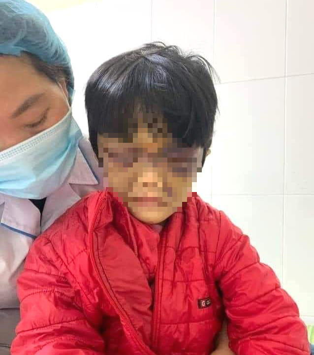 Cháu C. bị chính mẹ đẻ của mình bạo hành, đánh nhốt trong phòng trọ với thương tật 7%.