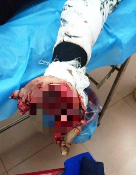 H&atilde;i h&ugrave;ng nam thanh ni&ecirc;n dập n&aacute;t b&agrave;n tay v&igrave; vừa d&ugrave;ng điện thoại vừa sạc