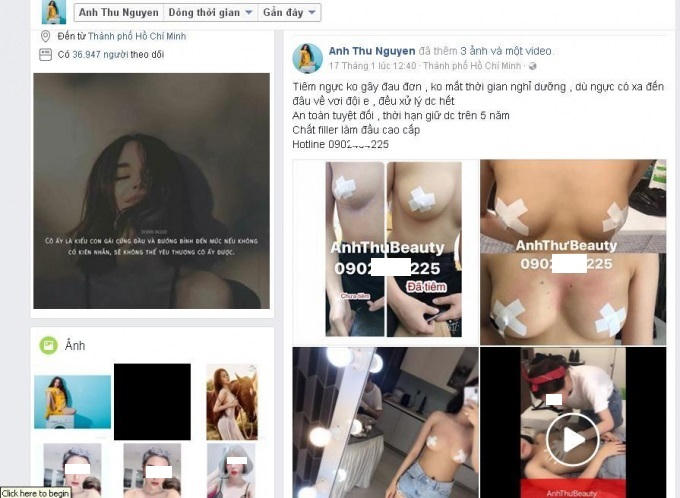 Tài khoản Anh Thu Nguyen quảng cáo hình ảnh tiêm thẩm mỹ có đính kèm số điện thoại có tên Anh Thu.