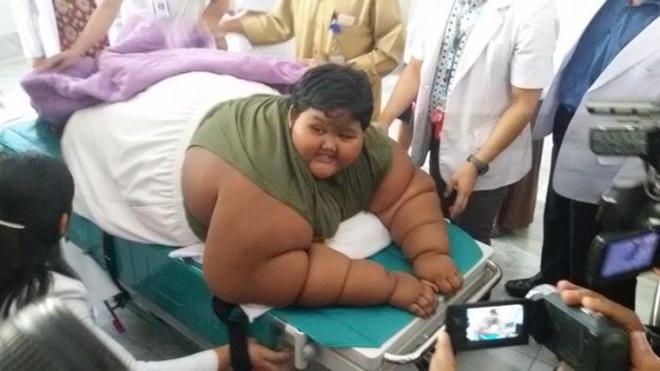Cậu bé Arya Permana, người Indonesia, nặng tới 192 kg. Ảnh: Web.de