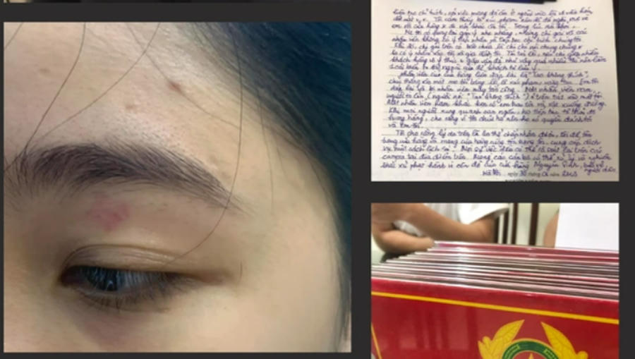 Hình ảnh cô gái bị nhân viên quán bánh mì Nguyên Sinh đánh