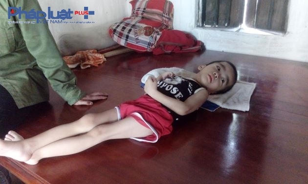 Cháu Bùi Văn Kiên hiện tại không thể đi lại, hoạt động như những đứa trẻ bình thường khác.