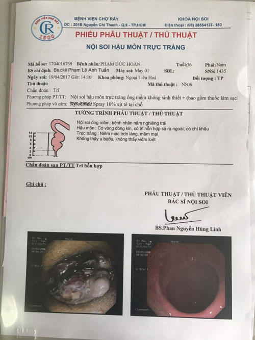 Phiếu phẫu thuật/thủ thuật số 1704016769 bằng phương pháp nội soi hậu môn trực tràng của Bệnh viện Chợ Rẫy kết luận thì anh Hoàn bị trĩ hỗn hợp. (ảnh H.A.T)