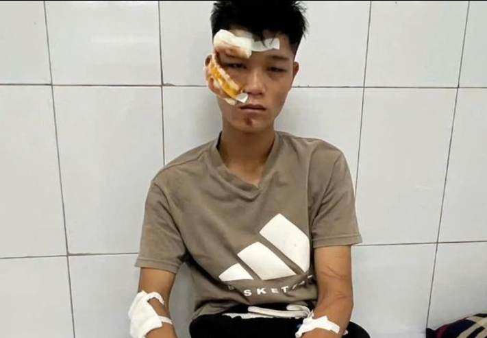 Đối tượng Nguyễn Văn Quân đang được điều trị tại bệnh viện. (Ảnh: VTCNews)