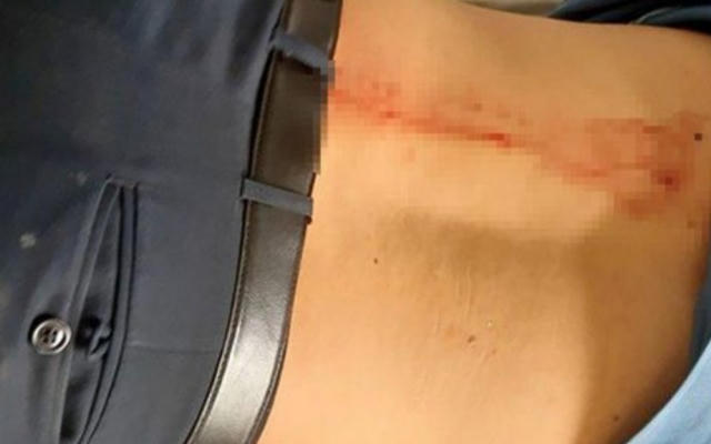 Đắk Nông: Bị nhắc nhở, nữ tiểu thương tấn công cán bộ QLTT