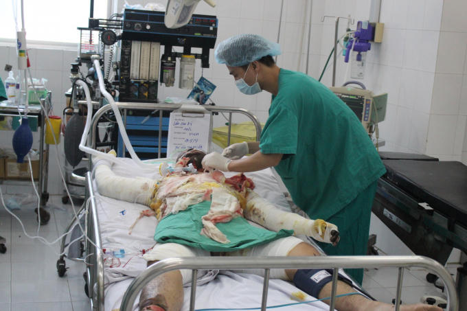 Cả hai nạn nhân đều bị bỏng nặng, tiên lượng xấu.