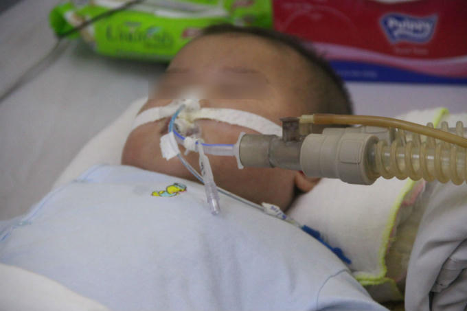 Nhiều ca l&uacute;c nhập viện, trẻ phải thở m&aacute;y, lọc m&aacute;u