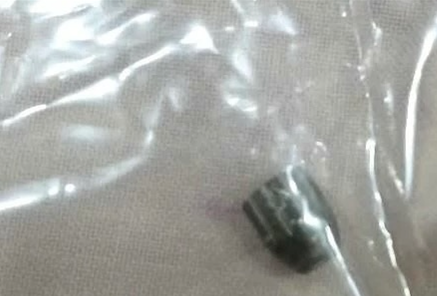 Đầu đạn được lấy ra từ người nạn nhân.