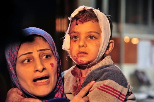 Rất nhiều trẻ em đã bị thương trong vụ tấn công khủng bố tại Syria. (Ảnh: AFP)