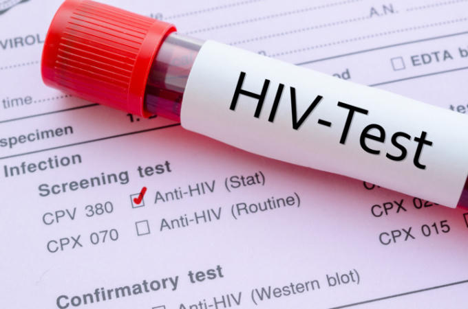 Cần nhanh chóng xử lý vết thương nghi phơi nhiễm HIV. Ảnh: minh họa