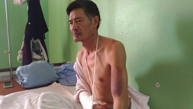 Ông Đỗ Viết Ba bị gãy tay, nhiều vết chém, cùng vợ đang điều trị tại bệnh viện Đa khoa Hợp Lực. (Ảnh: A.Thắng)