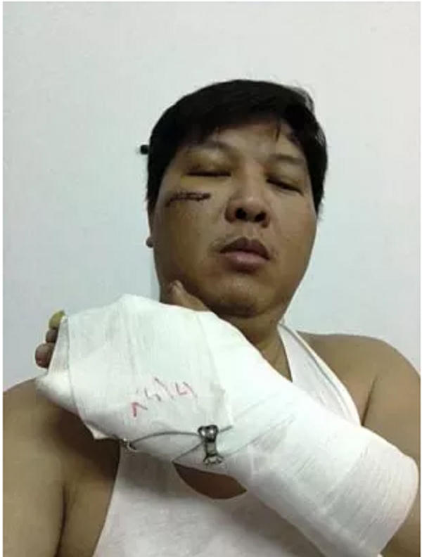 Ông Đinh Hữu Hướng cho rằng bị ông Võ Hữu Thành đánh, gây nhiều thương tích.