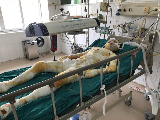 Chị H. sau khi xảy ra vụ việc