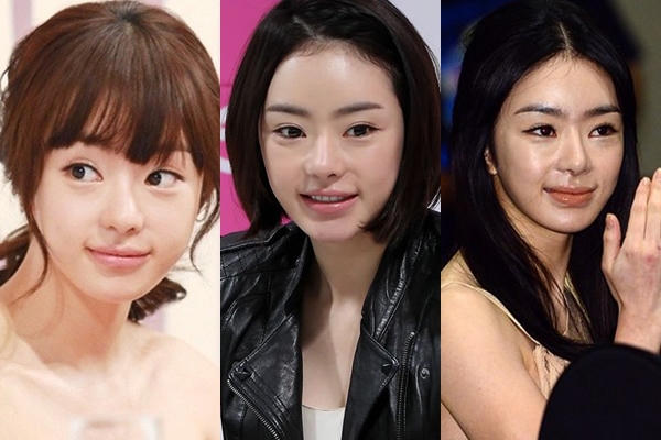 Từ diện mạo xinh xắn như búp bê, Seo Woo ngày càng khác lạ và kém sắc. Nữ diễn viên Cinderella's Sister là một trong những trường hợp lạm dụng phẫu thuật thẩm mỹ đáng tiếc nhất trong showbiz Hàn.