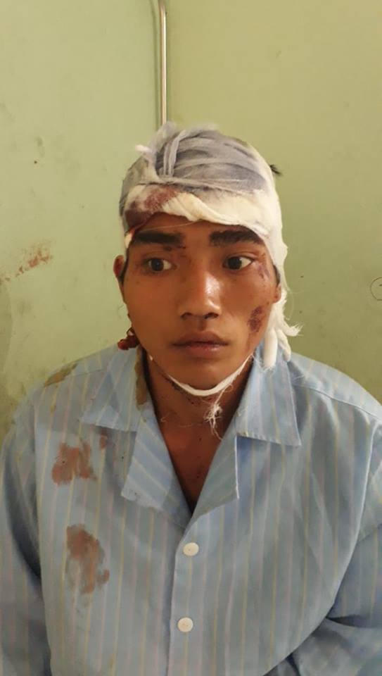 Trong cơn ảo giáo Hùng đã sát hại con gái mới 2 tuổi rồi chém trọng thương vợ mình.