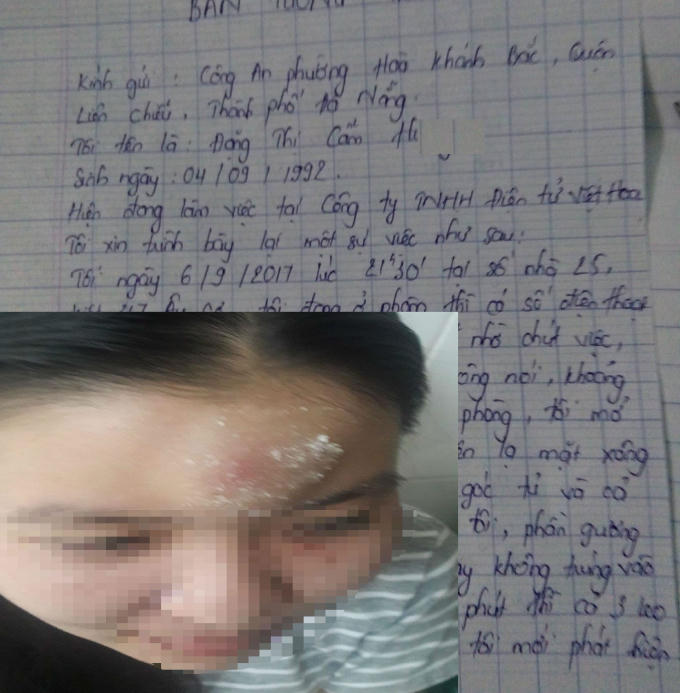 Chị H. (ảnh nhỏ) bị thương ở vùng mặt sau khi bị 3 kẻ lạ mặt hành hung ngay trong phòng trọ.