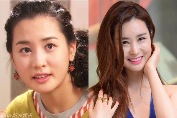 Phẫu thuật thẩm mỹ giúp Lee Da Hae xinh đẹp và quyến rũ hơn nhưng dường như nữ diễn viên đã lạm dụng chúng. Khuôn mặt của cô trở nên cứng nhắc, kém biểu cảm.