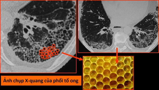 Anh149.